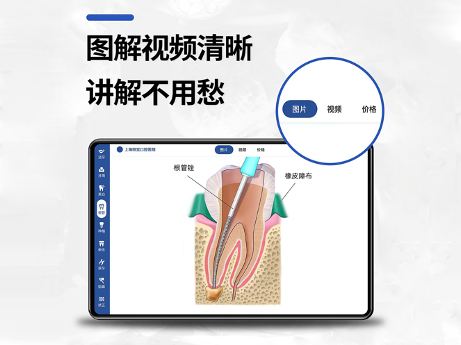 一分钟报价
